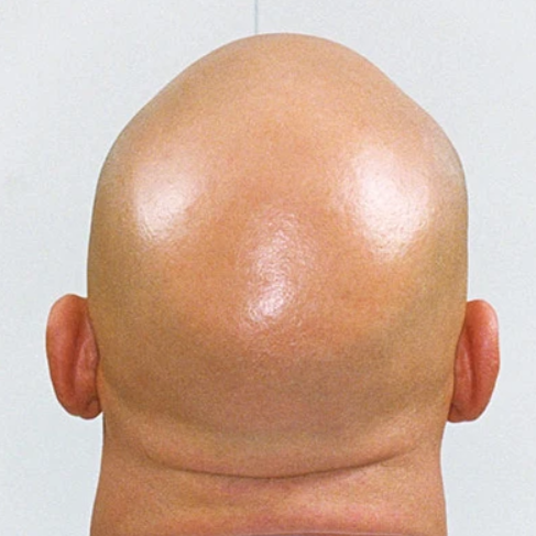 Foil Balding head shave all over